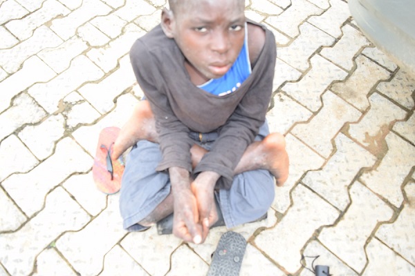 Read more about the article THE STORY OF THE 12YEARS OLD BASHIRU UMARU